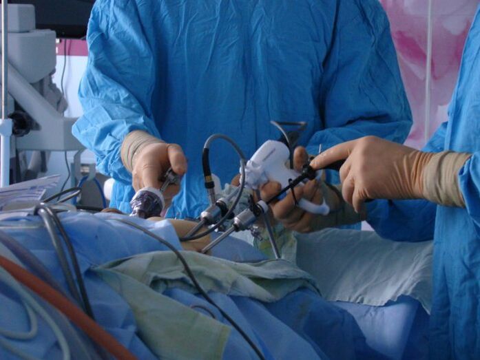 perlakuan bedah tina prostatitis