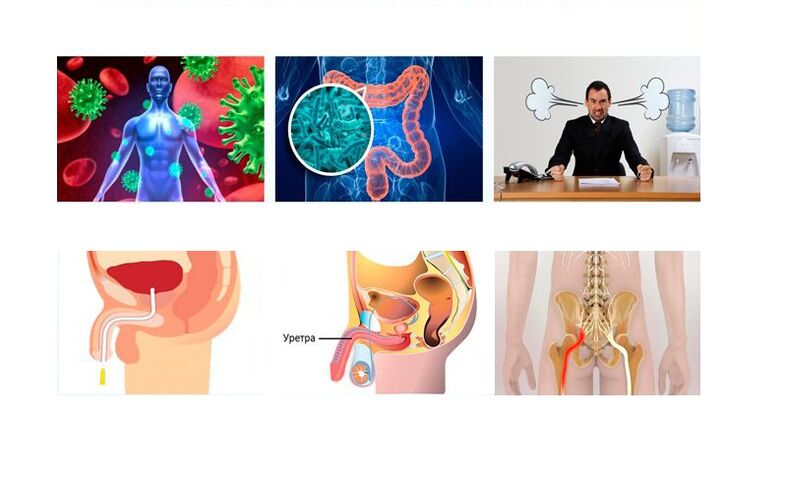 ngabalukarkeun prostatitis